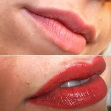 Before And Straight After Spmu Lips At The Annettepower Clinic In Harleystreet Www Annettepower C Semi Permanent Makeup Permanent Makeup Permanent Eyeliner