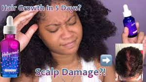 These days, early detection is key to treating hair loss. Hollywood Hair Bar Hair Growth Results More Youtube