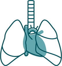 What are the more severe symptoms? Pericardial Mesothelioma Diagnosis Treatment Life Expectancy