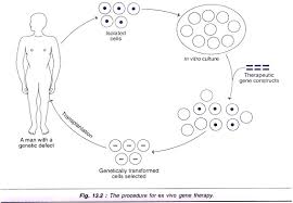 Gene Therapy Ex Vivo And In Vivo Gene Therapy With Diagram