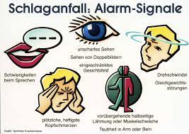 Der Schlaganfall