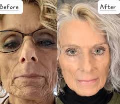 Klein Brak op sy Beste