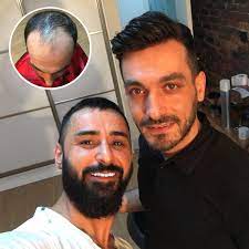 Nox Hair Protez Sac Merkezi En Twitter Protezsac Protezsacbakimi Protezsac Protezsacnedir Protezsacyapanfirmalar Noxhair Noxhairprotezsacmerkezi Noxhairprotezsac Kaliteliprotezsac Protezsacbakimlari Protezsacbakiminasilyapilir