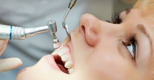 If you're wondering if you can eat after a filling, it's best to wait until after your local anesthetic wears off to ensure you don't chew on your tongue or your cheek without realizing it. When And What To Eat After Dental Cleaning Procedures Riverside Dental