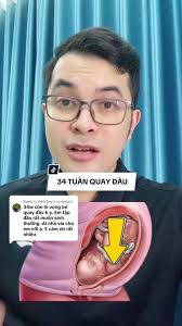 Thai Chưa Quay Đầu Tiếng Nhật Là Gì