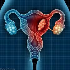 Myerscough}, journal in defining this condition we have excluded patients in whom the time which had elapsed since the menopause was less than one year, since. Postmenopausal Bleeding Common In Women With Endometrial Cancer