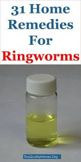 The key ingredient in most hand sanitizers is alcohol. 130 Aaa Ringworm Ideas Ringworm Ringworm Remedies Remedies