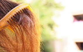To understand how hair gets damaged. Dry And Frizzy Hair 14 Natural Ways To Treat The Condition Vedix