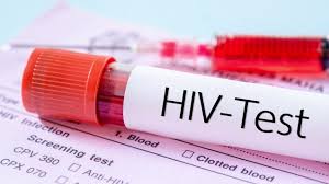 Maybe you would like to learn more about one of these? Bald In Apotheken Ministerium Pruft Zulassung Von Hiv Schnelltests Fur Zu Hause