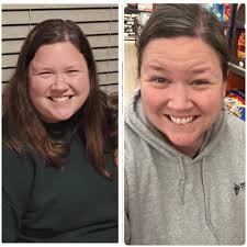 Relieving leg and hip pain after weight loss?