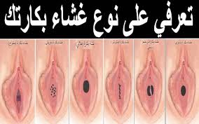 كيف اعرف اني عذراء بطرق بسيطة بالصور الجواب