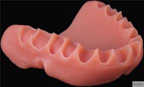 Cover denture prothesen sind deckprothesen und werden auch coverdenture, overdenture, hybridprothesen oder overlay denture genannt. Die Prothese Die Saugt Marktplatz Ztm Aktuell De