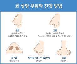 아무도 알려주지 않는 코 성형의 모든 것!! : 네이버 포스트