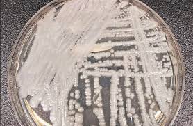 Image result for Buchnera candida