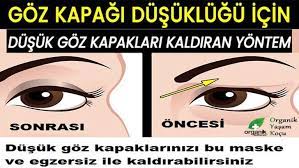 Goz Kapaklarindaki Sarkiklar Yalnizca Insanlari Daha Yasli Gostermez Ayni Zamanda Gorus Acilarini Da Kisitlar Bazi Istatistikler Her Yil 100 Binden Fazla