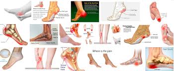 Pin On Health