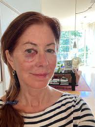 WC Actress Okay After Rough Tumble (February 19, 2022)