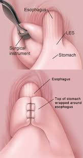 Pin On General Surgery Procedures
