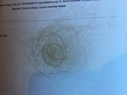 wie viele haare bei jedem tag waschen verlieren und wie viele haare beim jeden zweiten tag waschen verlieren ausfall