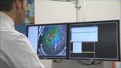 New study presents impressive results of nexstim smartfocus® ntms language mapping. Nexstim Youtube