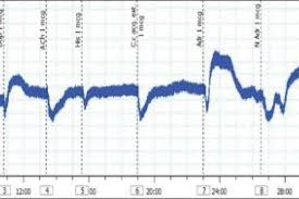 Image result for Cleistanthus schlechteri