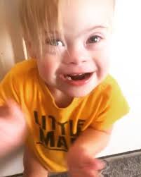 Treg saves his best dance moves for food🕺🏼🍌🌮, And that’s what this  weeks question is all about! A lot of people with ds have a variety of  needs when it comes to what goes in to their tummies, how, and ...