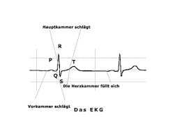 An ekg is a paper or digital recording of the electrical signals in the heart. Theheart De Khk Untersuchungs Techniken
