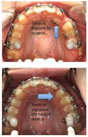 Pin On Before After