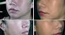 Biotin Before And After Men