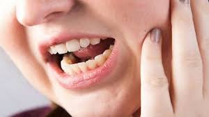 Image result for Trismus