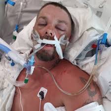 Fundraiser by Barbara Zapata : Donate to Steven Benson's Lifesaving  Surgeries