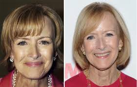 19.05.2020 · jeanine pirro plastic surgery before and after photos. Judy Woodruff Plastic Surgery Face Lift Before And After Photos Celeblens Com