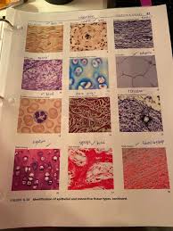 Epithelial tissue provides a covering (skin. Solved What Type Of Connective Tissue Is Shown In Ewhat T Chegg Com
