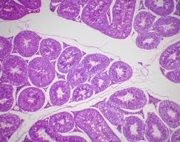 Check spelling or type a new query. Testicular Biopsy
