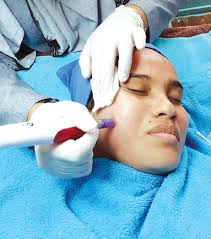 Cara penggunaan krim hapus parut untuk hasil yang terbaik. Rawat Parut Berkawah
