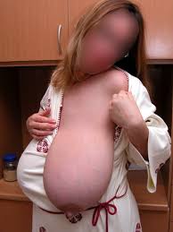 Below we mention 20 best natural home remedies and tips for having bigger breast. The Biggest Tits In The World Busty Girls Huge Boobs 100 Natural