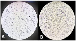 Image result for Rhodococcus equi