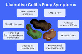 Image result for blood in stool human poop