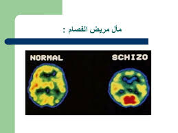 الفصل السادس مساعدات التذكر Mnemonics المحاضرة رقم Ppt Telecharger