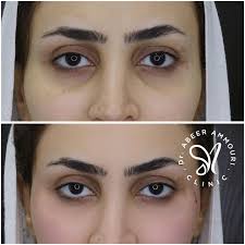 Dr.Abeer Ammouri (@dr_abeerammouri) • Photos et vidéos Instagram