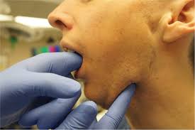 Image result for Submandibular Exam