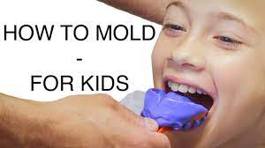 If you are getting your mouth guard poking into the mouth, especially in your back jaws, you can trim the mouth guard by using scissors. How To Mold A Mouthguard Custom For Kids Prochocs Youtube