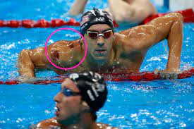Andrew was a youth soccer. Spots On Michael Phelps What Is Cupping