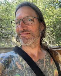 So, a quick update for anyone interested. Looks like surgery won't be  necessary… no procedure of any kind, actually. With my arm immobilized we  now allow gravity to return the broken pieces