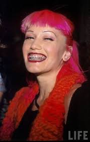 Gwen Stefani Gwen Stefani Pictures Gwen Stefani Celebrities With Braces