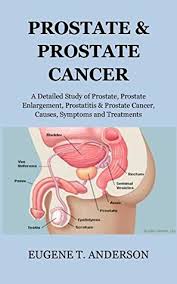 Pain in the bones of those areas loss of weight and appetite fatigue,. Prostate Prostate Cancer A Detailed Study Of Prostate Enlarged Prostate Prostatitis Prostate Cancer Causes Symptoms And Treatments By Eugene T Anderson