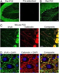 Maybe you would like to learn more about one of these? Influence Of Spatially Segregated Ip3 Producing Pathways On Spike Generation And Transmitter Release In Purkinje Cell Axons Pnas