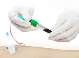 Image result for Venous Blood Sampling