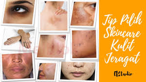 Produk2 ni memang berlambak kat pasaran so kalau korang pernah terfikir2 nak belanja duit untuk benda2 ni, buat kajian baik2. Tips Pilih Skincare Kulit Jeragat By Nurul Aziyana