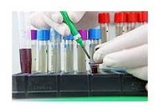 În funcție de care celule emană leucemia acută ele sunt aproape întotdeauna mărită în leucemie acută. Analize Biochimice Ale Sangelui Modificari Ale Transaminazelor Hepatice